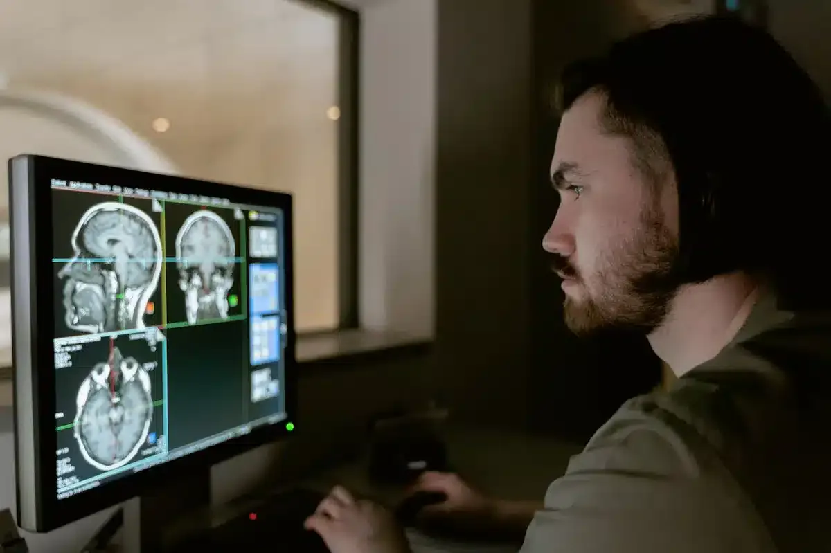 Doctor examining brain scan on a monitor