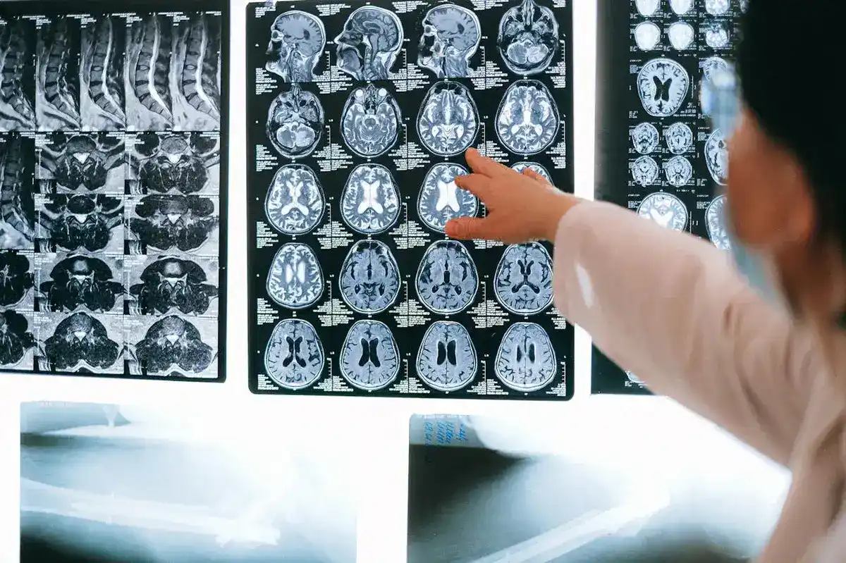 Doctor pointing at brain scan of a patient